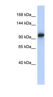 Western Blot: VPS54 Antibody [NBP1-57579]