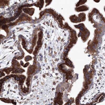 Immunohistochemistry-Paraffin: VPS8 Antibody [NBP1-82007]