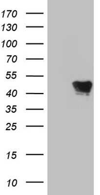 Western Blot: VRK1 Antibody (OTI2C9) [NBP2-46351]