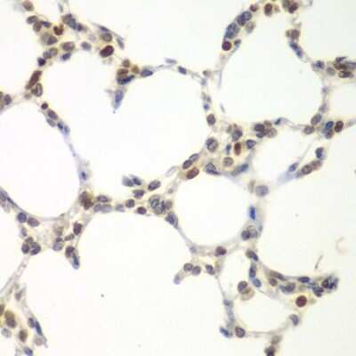 Immunohistochemistry-Paraffin: VRK1 Antibody - BSA Free [NBP2-93500]
