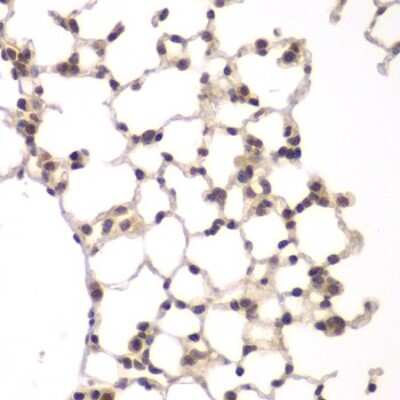 Immunohistochemistry-Paraffin: VRK1 Antibody - BSA Free [NBP2-93500]