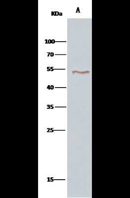 Immunoprecipitation: VRK1 Antibody [NBP2-99819]