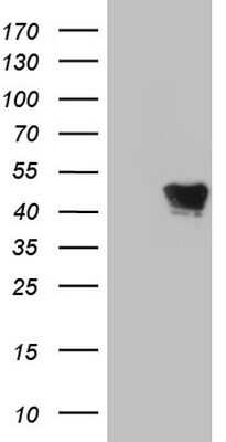 Western Blot: VRK1 Antibody (OTI2C9)Azide and BSA Free [NBP2-74855]