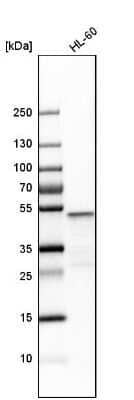 Western Blot: VRK1 Antibody [NBP1-85822]