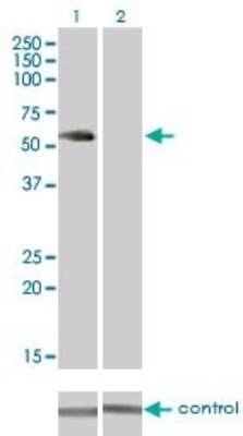 Western Blot: VRK2 Antibody (3B10) [H00007444-M01]