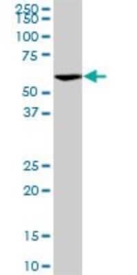 Western Blot: VRK2 Antibody (3B10) [H00007444-M01]