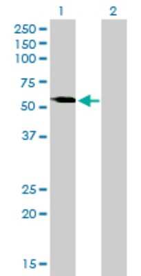Western Blot: VRK2 Antibody (3B10) [H00007444-M01]