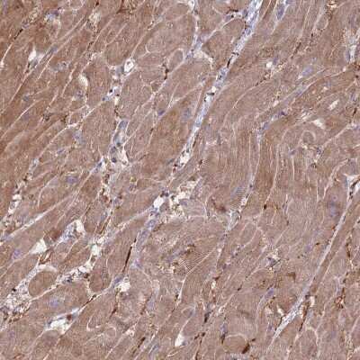 Immunohistochemistry-Paraffin: VRK2 Antibody [NBP2-48875]