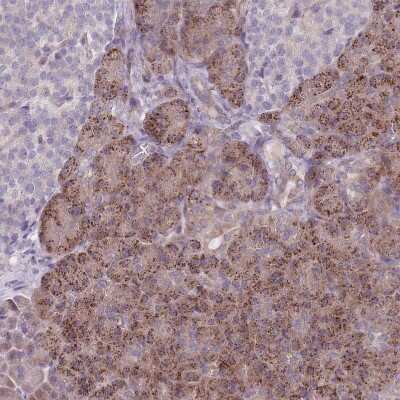 Immunohistochemistry-Paraffin: VRK2 Antibody [NBP2-48875]