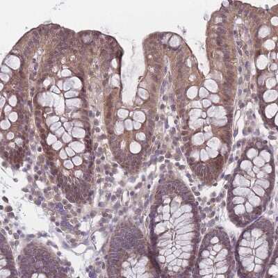 Immunohistochemistry-Paraffin: VRK2 Antibody [NBP2-48875]