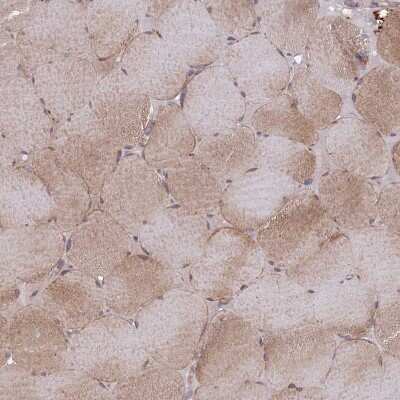 Immunohistochemistry-Paraffin: VRK2 Antibody [NBP2-48875]