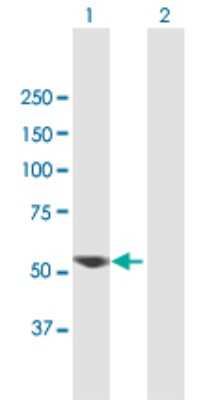 Western Blot: VRK2 Antibody [H00007444-B01P]