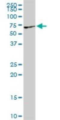 Western Blot: VRK2 Antibody [H00007444-D01P]