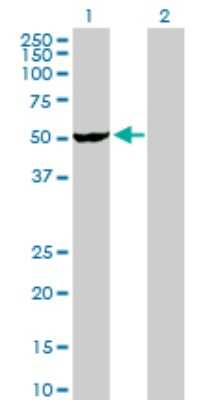 Western Blot: VRK2 Antibody [H00007444-D01P]