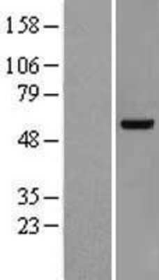 Western Blot: VRK2 Overexpression Lysate [NBP2-09512]