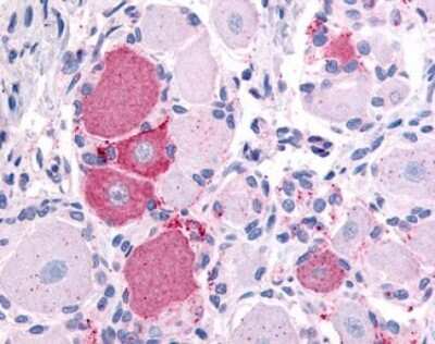 Immunohistochemistry-Paraffin: VRL1 Antibody - BSA Free [NBP2-25068]