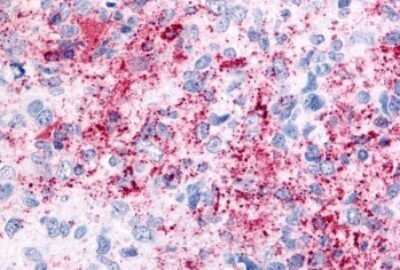 Immunohistochemistry-Paraffin: VRL1 Antibody - BSA Free [NBP2-25068]