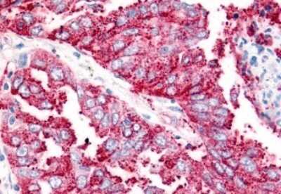 Immunohistochemistry-Paraffin: VRL1 Antibody - BSA Free [NBP2-25068]