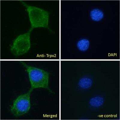 Immunocytochemistry/ Immunofluorescence: VRL1 Antibody [NBP1-00139]