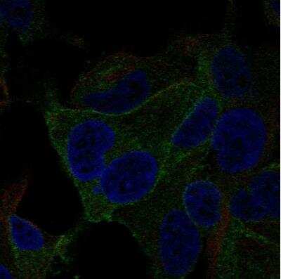 Immunocytochemistry/ Immunofluorescence: VRL1 Antibody [NBP1-92576]