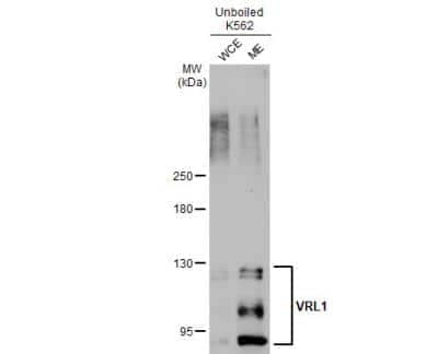 Western Blot: VRL1 Antibody [NBP1-32096]