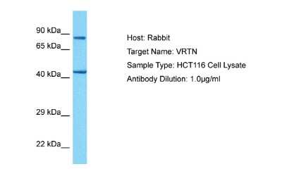 Western Blot: VRTN Antibody [NBP2-83757]