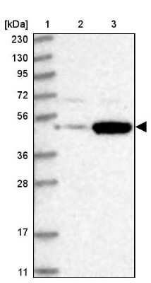 Western Blot: VSIG1 Antibody [NBP1-81073]
