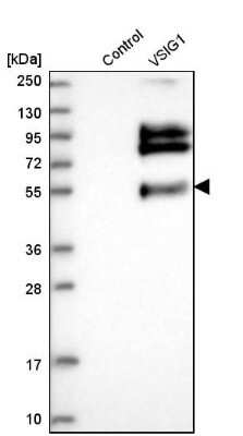 Western Blot: VSIG1 Antibody [NBP1-81074]