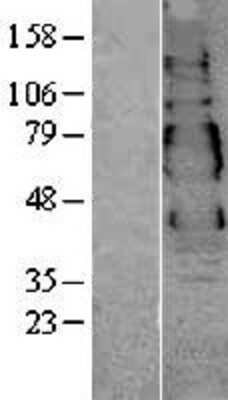 Western Blot: VSIG1 Overexpression Lysate [NBL1-17761]