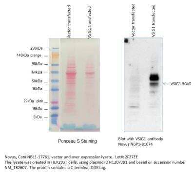 Western Blot: VSIG1 Overexpression Lysate [NBL1-17761]