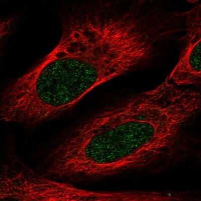 Immunocytochemistry/ Immunofluorescence: VSIG10L Antibody [NBP2-55147]