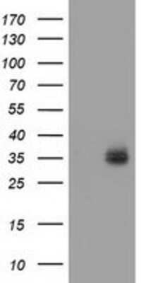 Western Blot: VSIG2 Antibody (OTI2D8) [NBP2-03376]