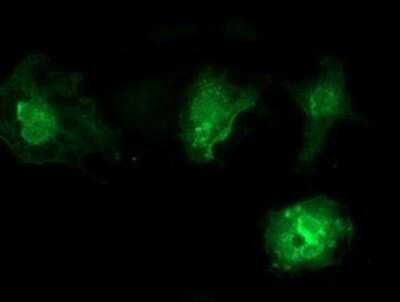 Immunocytochemistry/ Immunofluorescence: VSIG2 Antibody (OTI2D8) - Azide and BSA Free [NBP2-74858]