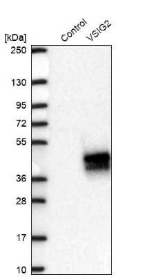 Western Blot: VSIG2 Antibody [NBP2-48955]