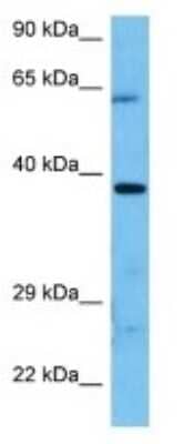 Western Blot: VSIG2 Antibody [NBP3-10182]