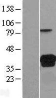 Western Blot: VSIG2 Overexpression Lysate [NBL1-17762]