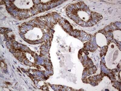 Immunohistochemistry: VSIG3/IGSF11 Antibody (OTI2H1) - Azide and BSA Free [NBP2-74861]