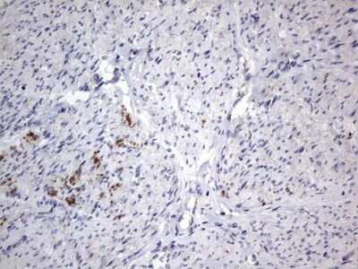 Immunohistochemistry: VSIG3/IGSF11 Antibody (OTI2H1) - Azide and BSA Free [NBP2-74861]