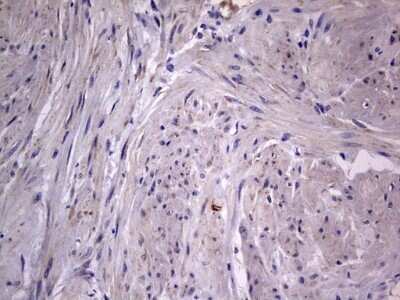 Immunohistochemistry: VSIG3/IGSF11 Antibody (OTI2H1) - Azide and BSA Free [NBP2-74861]