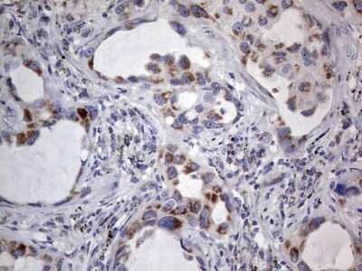 Immunohistochemistry: VSIG3/IGSF11 Antibody (OTI2H1) - Azide and BSA Free [NBP2-74861]