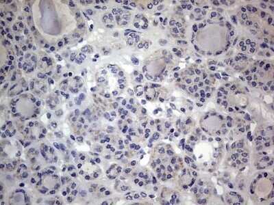 Immunohistochemistry: VSIG3/IGSF11 Antibody (OTI2H1) - Azide and BSA Free [NBP2-74861]