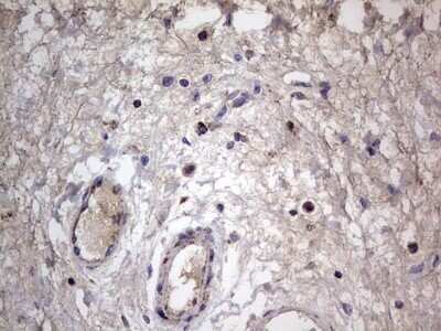 Immunohistochemistry: VSIG3/IGSF11 Antibody (OTI2H1) - Azide and BSA Free [NBP2-74861]