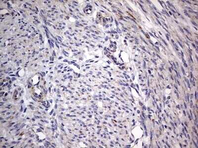 Immunohistochemistry: VSIG3/IGSF11 Antibody (OTI2H1) - Azide and BSA Free [NBP2-74861]