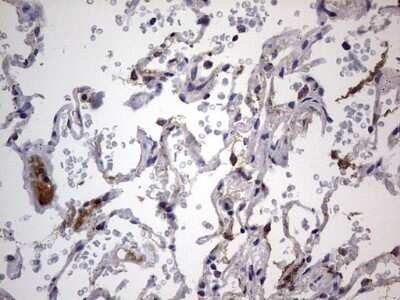 Immunohistochemistry: VSIG3/IGSF11 Antibody (OTI2H1) - Azide and BSA Free [NBP2-74861]