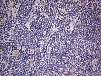 Immunohistochemistry: VSIG3/IGSF11 Antibody (OTI2H1) - Azide and BSA Free [NBP2-74861]