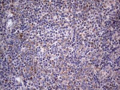 Immunohistochemistry: VSIG3/IGSF11 Antibody (OTI2H1) - Azide and BSA Free [NBP2-74861]