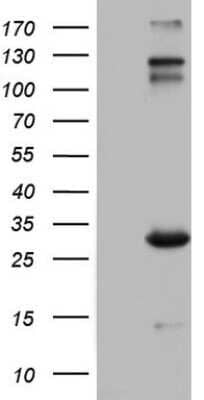 Western Blot: VSIG3/IGSF11 Antibody (OTI2H1)Azide and BSA Free [NBP2-74861]