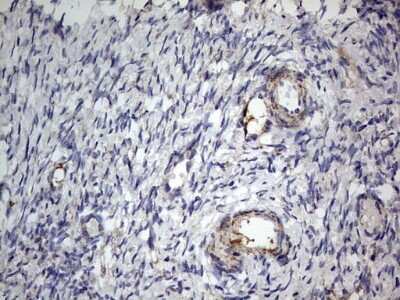 Immunohistochemistry: VSIG3/IGSF11 Antibody (OTI2H1) [NBP2-46046]