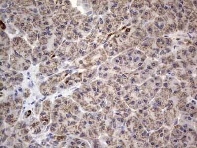 Immunohistochemistry: VSIG3/IGSF11 Antibody (OTI2H1) [NBP2-46046]
