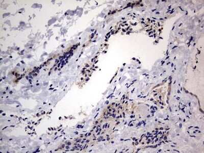 Immunohistochemistry: VSIG3/IGSF11 Antibody (OTI2H1) [NBP2-46046]
